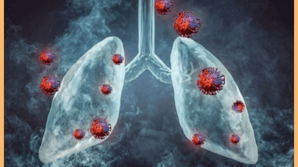 Human Metapneumovirus (HMPV)